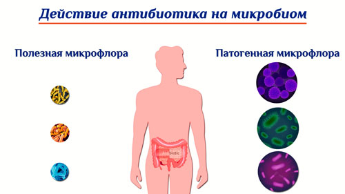 Расстройство стула при антибиотиках