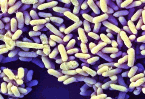 Bifidobacterіum infantis