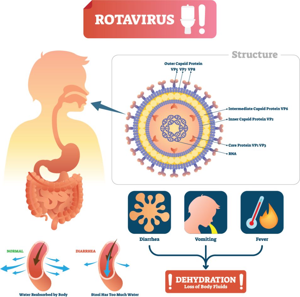 Диарея, понос у новорожденного признаки, причины, лечение. Симптомы и  лечение ротавирусной инфекции - Университет здорового ребёнка Няньковских