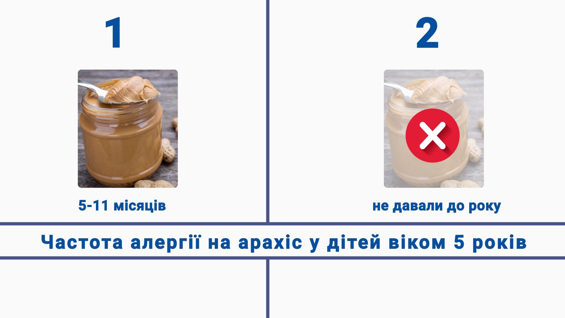 Частота алергії на арахіс у дитини в 5 років