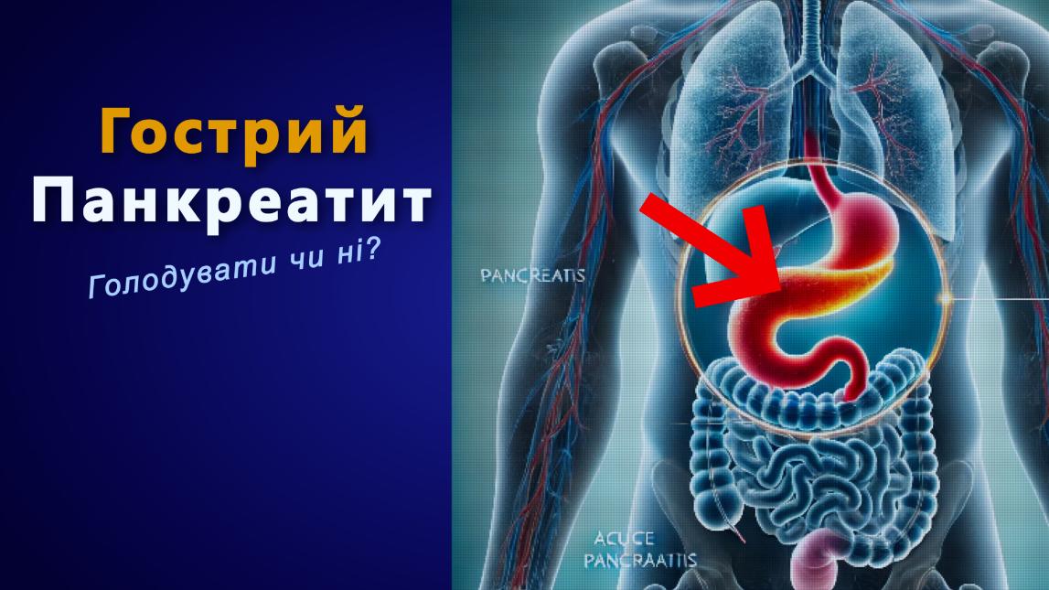 Чи потрібно голодувати при гострому панкреатиті. Рекомендації від Олени Няньковської