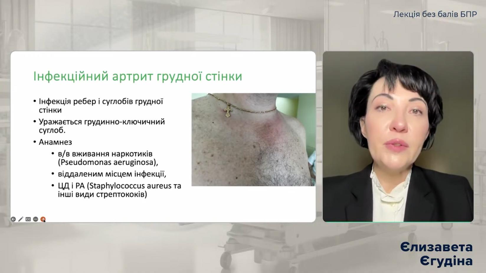 Єлизавета Єгудіна професор лікар Кардіометаболічний форум. Кардіометаболічні захворювання від діагностики до лікування