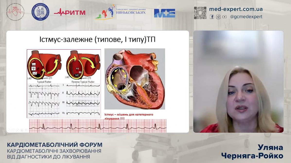 Уляна Черняга-Ройко кардіолог на Кардіометаболічному форумі. Кардіометаболічні захворювання від діагностики 