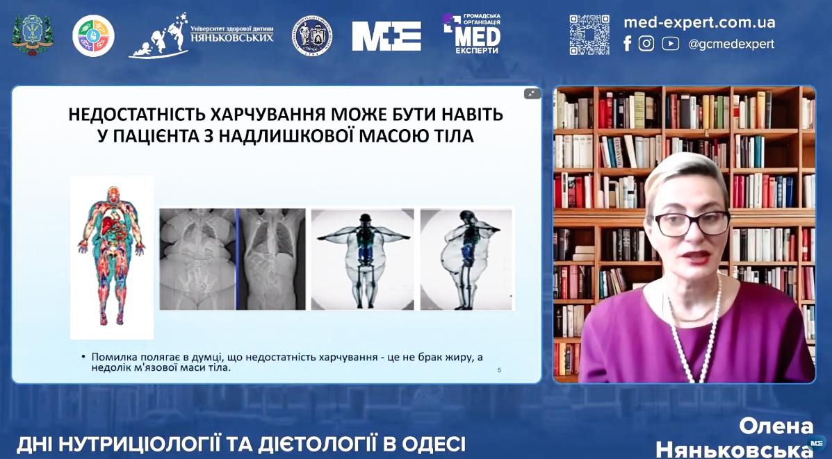 лікар дієтолог гастроентеролог Олена Няньковська про доказову дієтологію та ожиріння