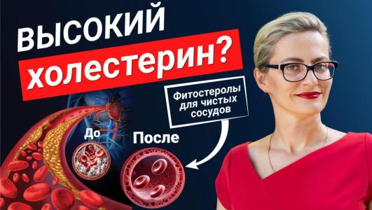 Повышенный холестерин - как снизить без лекарств? Топ продуктов, которые снижают холестерин